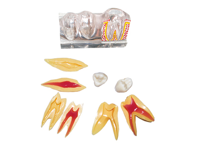 HST-M4-02 4Times Sized Tooth Disassebling
