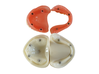 HST-T21 Full Denture Impant Model HST-T21 Full Denture Impant Model